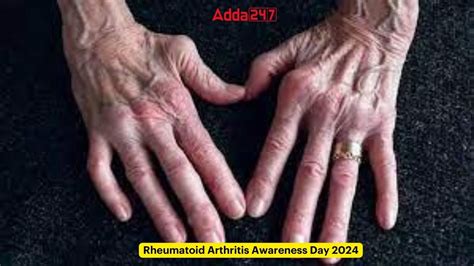 rheumatoid arthritis near corte madera 1% higher than the U